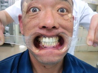 被害者の負担10割(p_-)傷は癒えてもその痛みは忘れない 被害者の負担10割(p_-)傷は癒えてもその痛みは忘れない