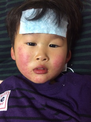 病名が分からない・・・